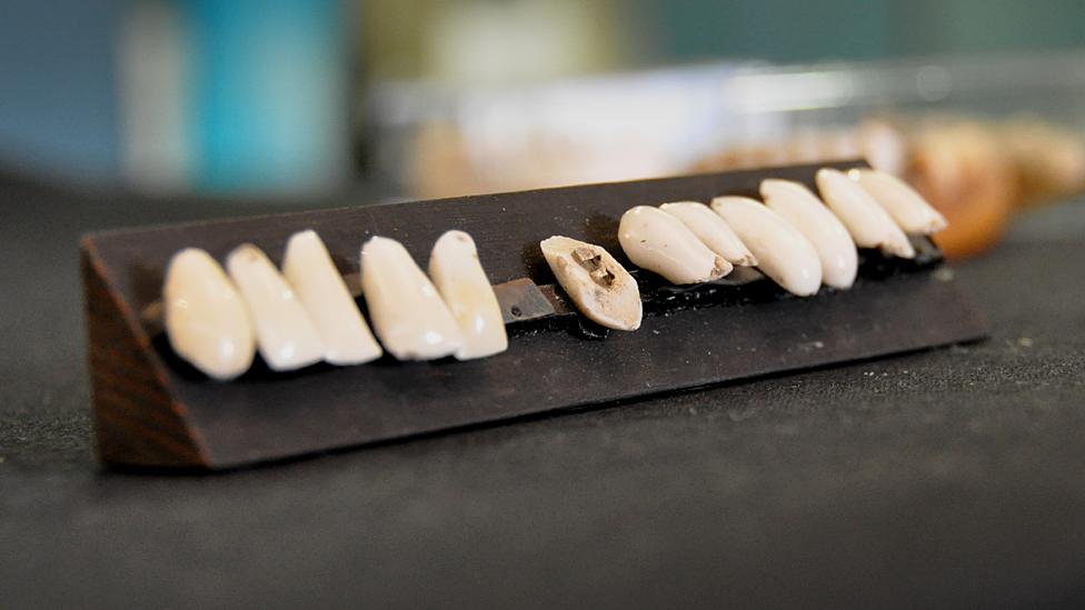 19th Century false teeth