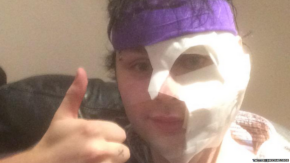 Michael posted a picture of his face in bandages with his thumb up