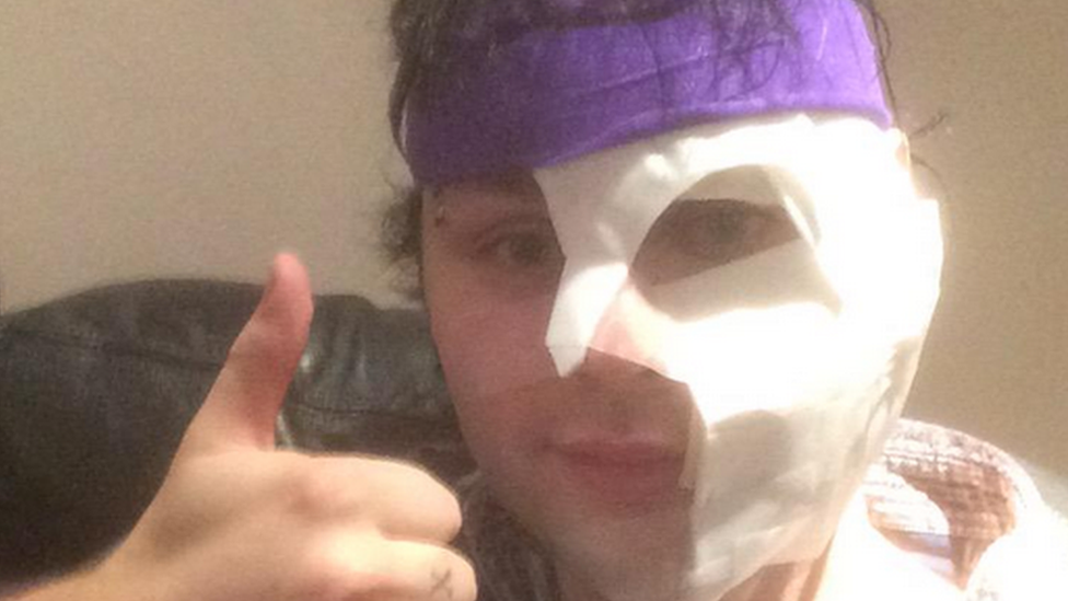 Michael posted a picture of his face in bandages with his thumb up