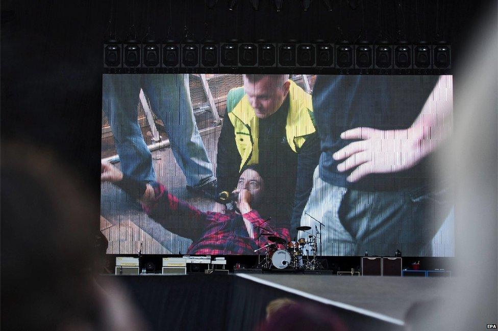 Dave Grohl lies on stage after fracturing his leg