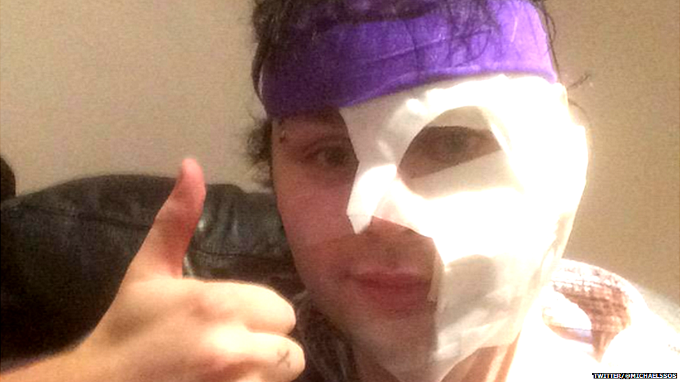 Michael posted a picture of his face in bandages with his thumb up