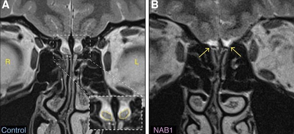 Brain scans