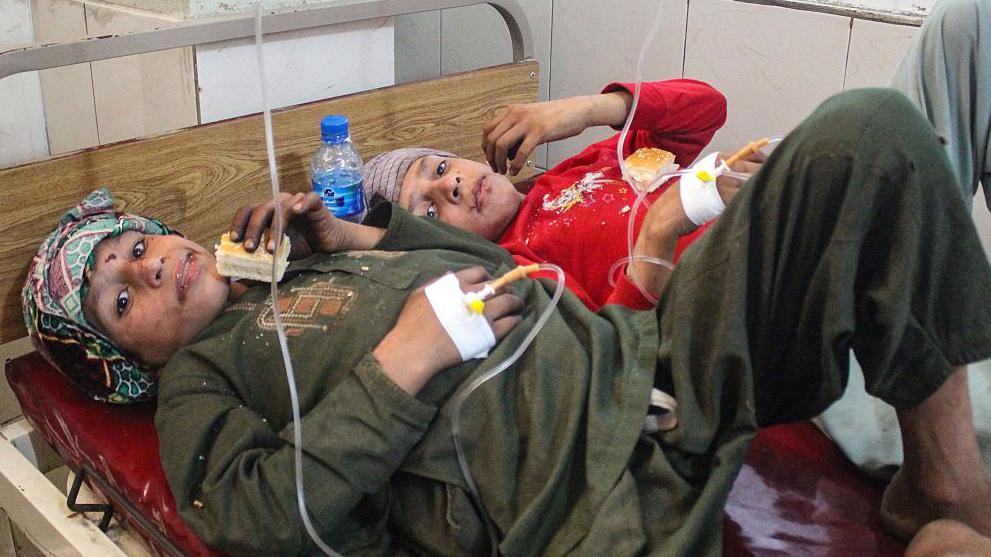 Injured Afghan children receive treatment at a hospital after an earthquake in Jalalabad, in eastern Afghanistan, on September 1, 2025. A