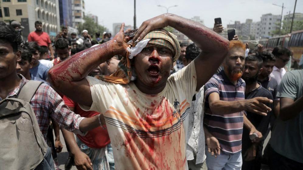 An injured protester is rushed to hospital after a clash with police and Awami League supporters at the Rampura area in Dhaka, Bangladesh, July 18, 2024