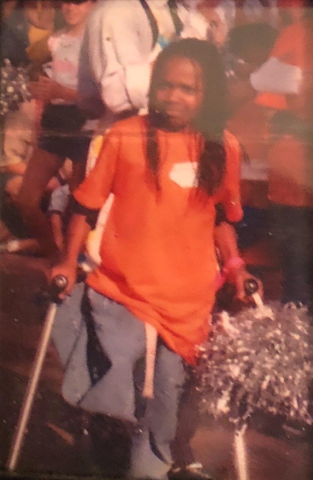 Abena Christine Jon'el as young girl using crutches. She is wearing an orange T-shirt and the trousers on her right leg are folded up at the knee.