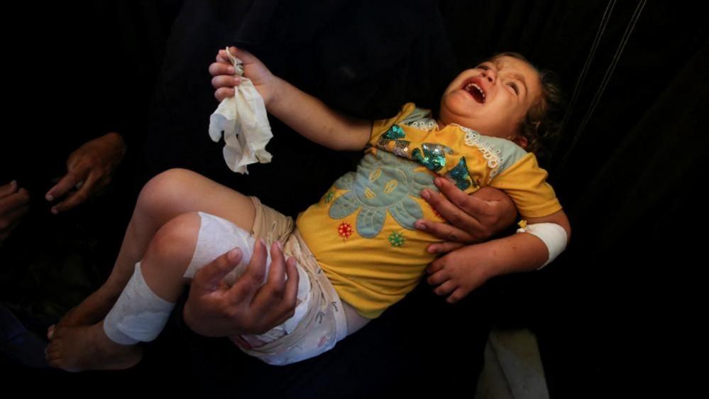 An injured toddler cries as they are being carried with bandages over their arm and legs