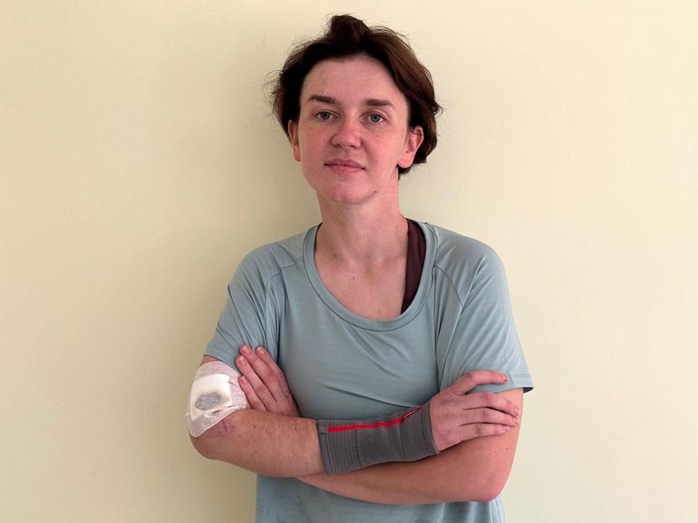 Andriana, pictured with a bandaged arm, at the rehabilitation centre in Ukraine