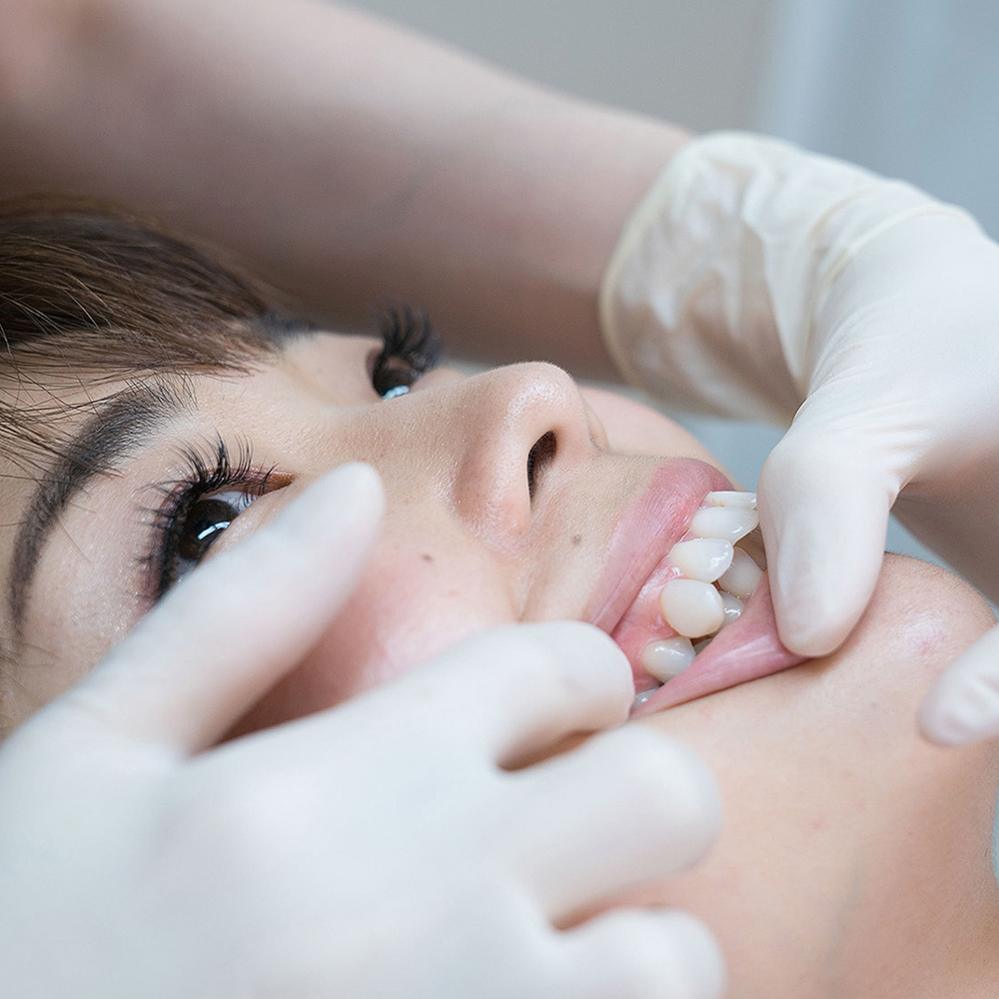 Dentist fitting a yaeba tooth