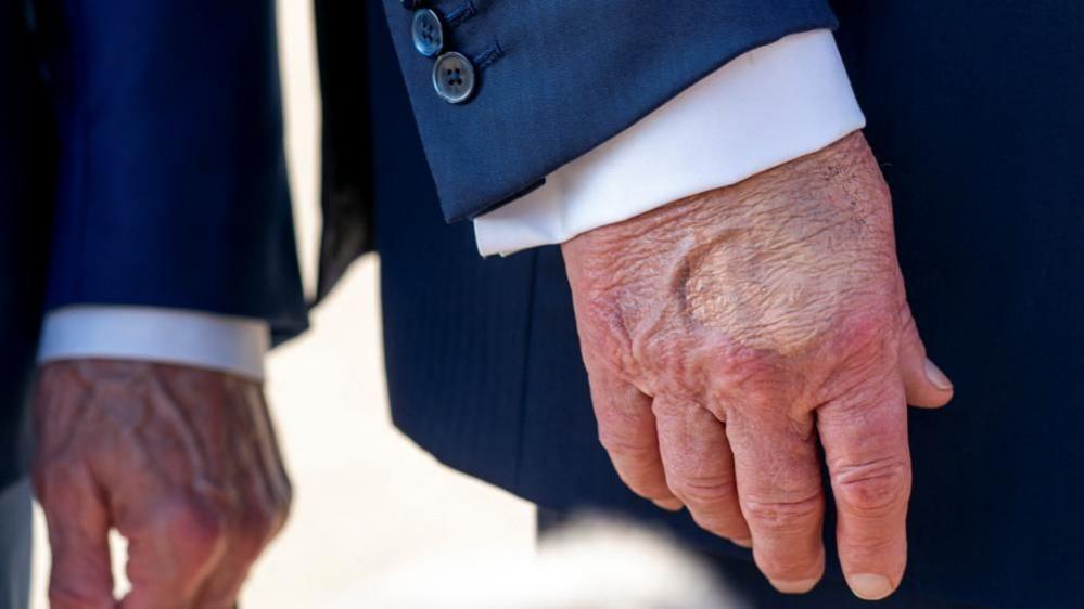 A close-up of the back of Trump's hand, which has a clear patch of makeup on it below the pointer and middle finger knuckles