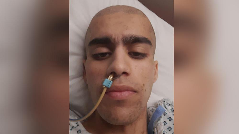 A young man with a shaved head lies in a hospital bed with a tube in his nose. 