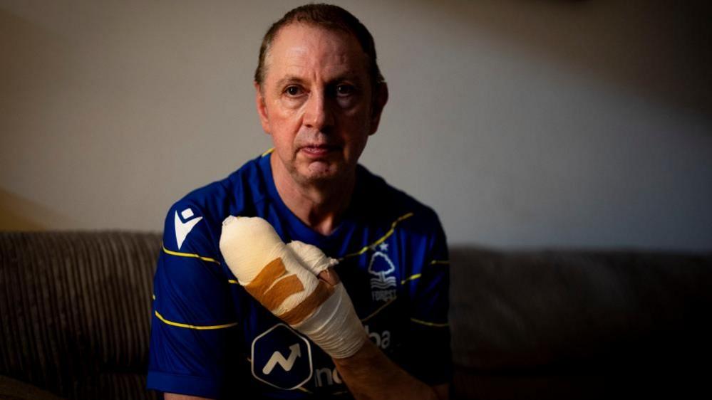 Stephen Crean with a bandaged hand