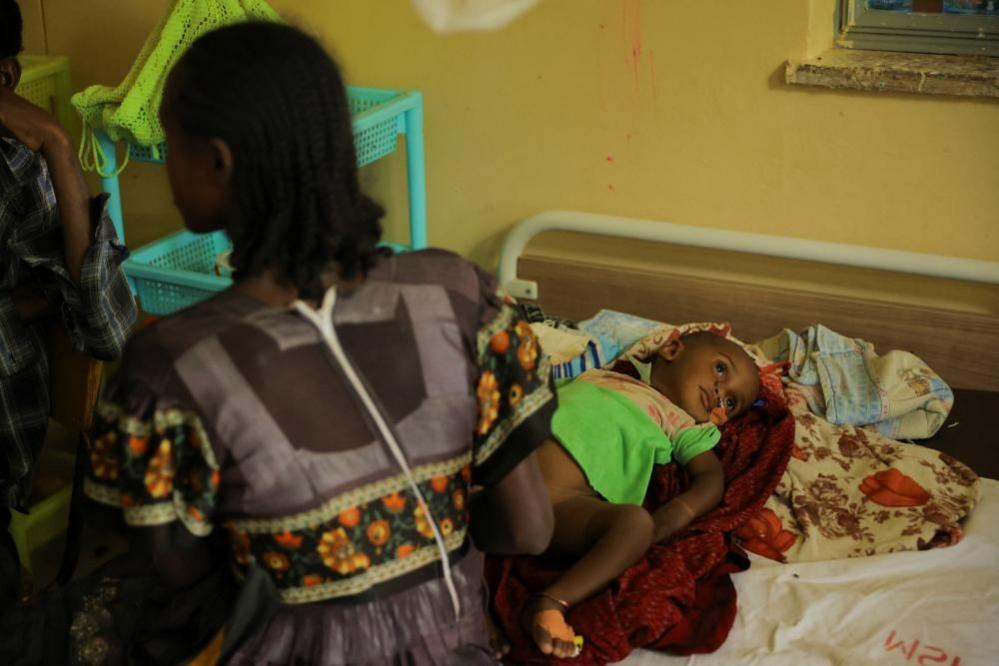 A woman sits with her malnourished one-year-old daughter as they wait for her to receive treatment at Abi Adi General Hospital in the Tigray Region, Ethiopia. The baby is lying on a bed. The mother is sitting next to the baby with her back to the camera. 