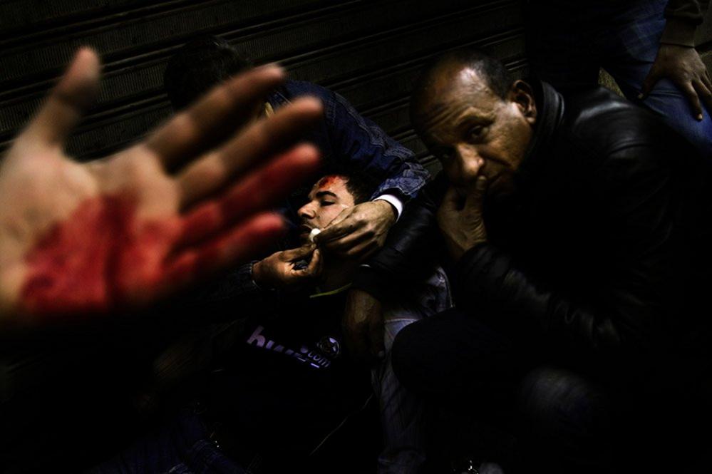 Wounded in Tahrir Square