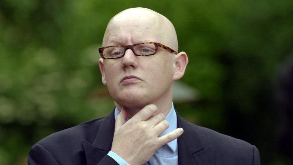 David Yelland with bald head and brown glasses, wearing a grey jackey with his right hand touching his neck