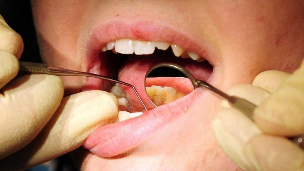 A person's mouth is open. A person wearing rubber yellow gloves is using dental tools to do a check-up of their teeth.