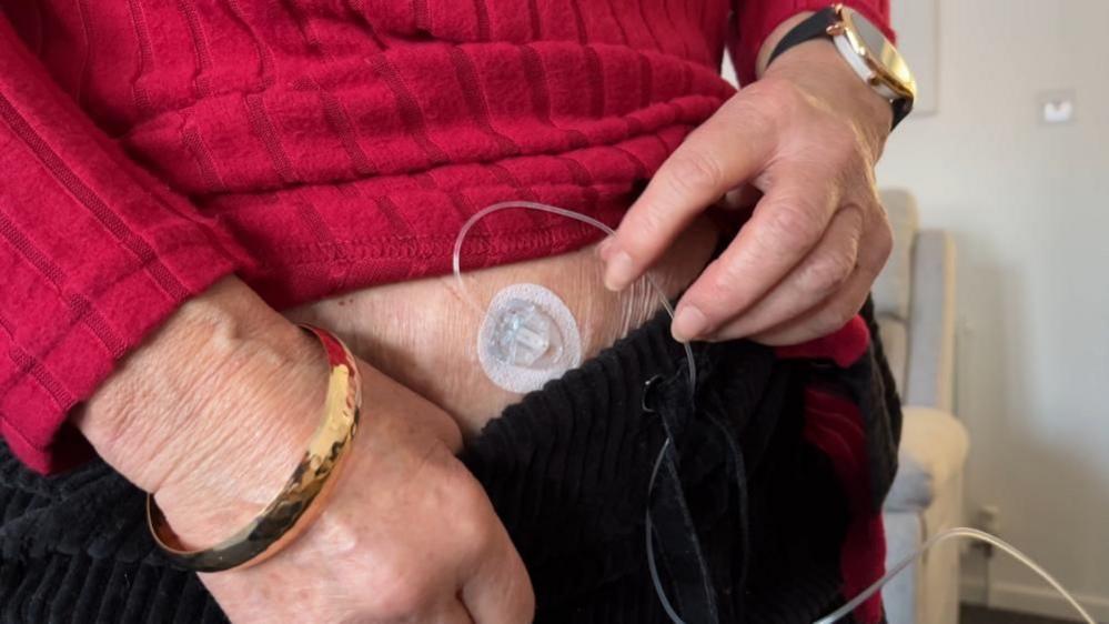 A close up of a canula attached to the stomach of Jan Fuller, who is wearing a gold bangle, red knitted top and black trousers.