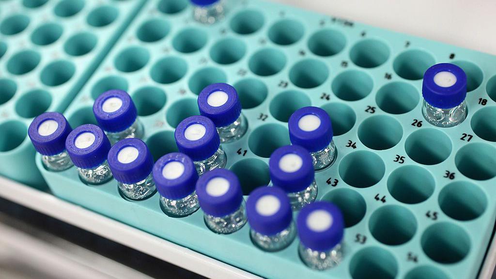 A tray of samples in the anti-doping laboratory which tested athlete’s samples at the London 2012 Games on 19 January 2012 in Harlow, UK.