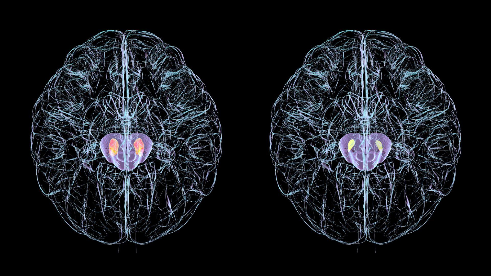 Ilustración de dos cerebros