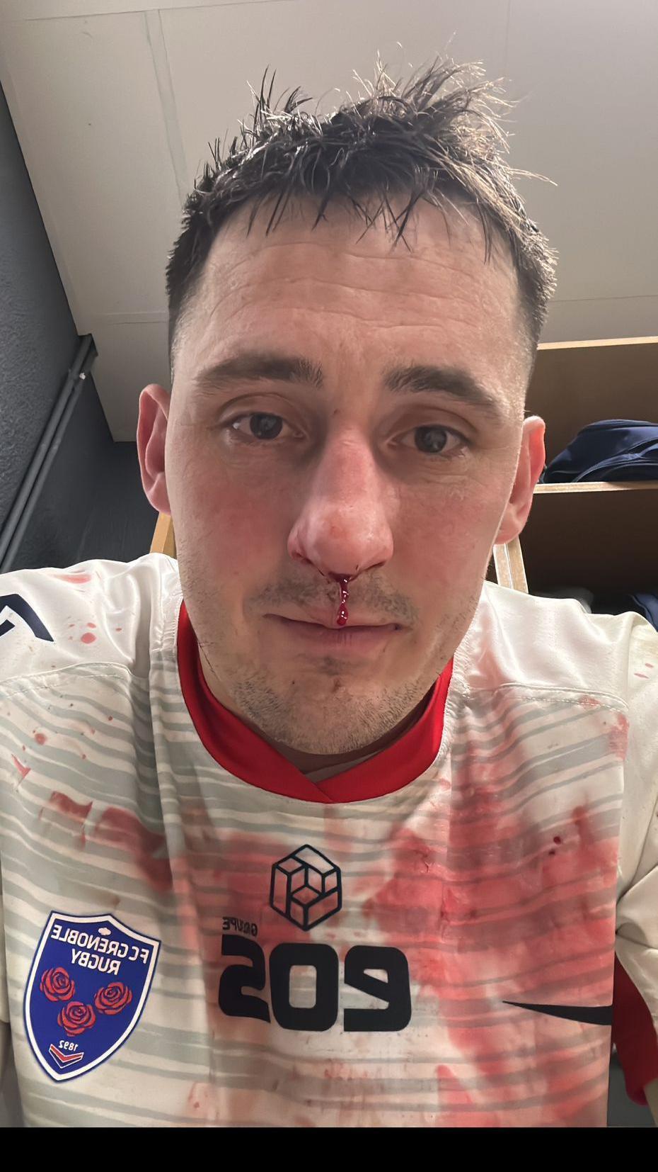 Sam Davies in a bloodied Grenoble rugby jersey 