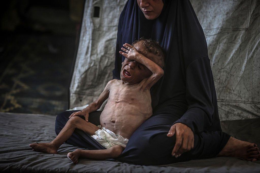 Una madre palestina junto a su hijo desnutrido en Gaza.