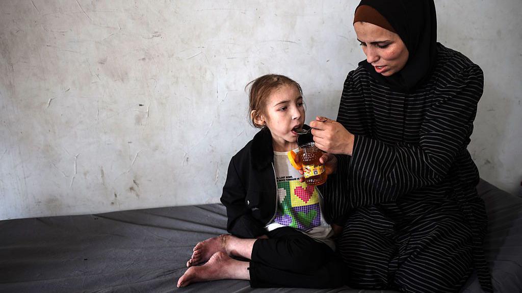 Shuruq trata de consolar a su hija Rafah, de 12 años, que como tantos otros niños sufre de desnutrición.