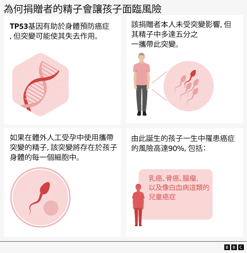 BBC製圖解釋為何捐贈者的精子會讓孩子面臨風險