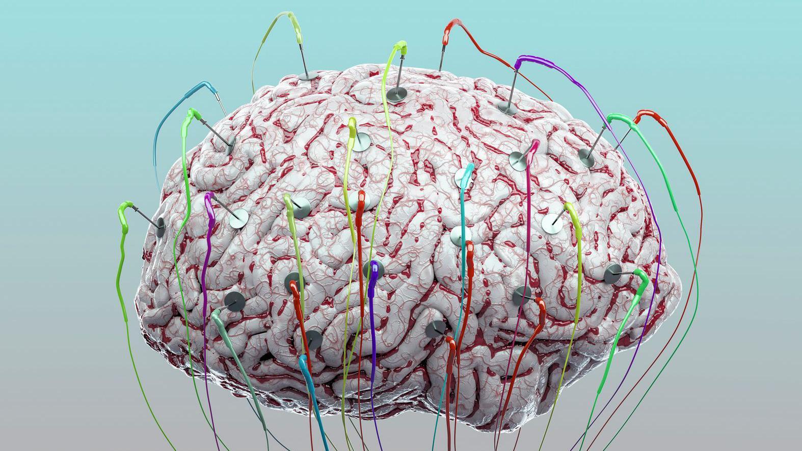 Imagen de un cerebro suspendido sobre un fondo claro con electrodos de colores adheridos a él.