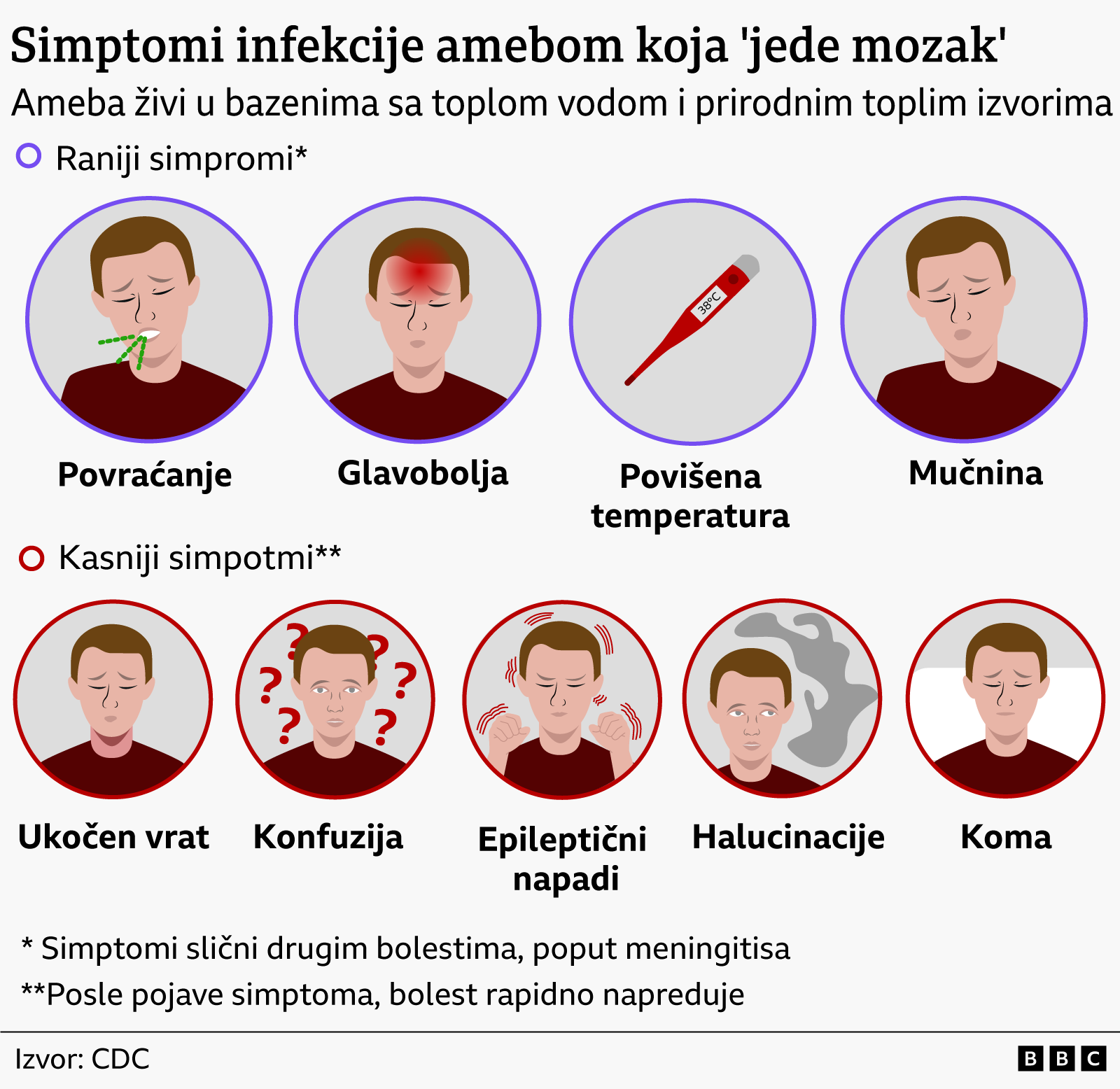'Kao u horor filmu': Ameba koja jede mozak bi mogla da se proširi po svetu 5 ameba, grafik