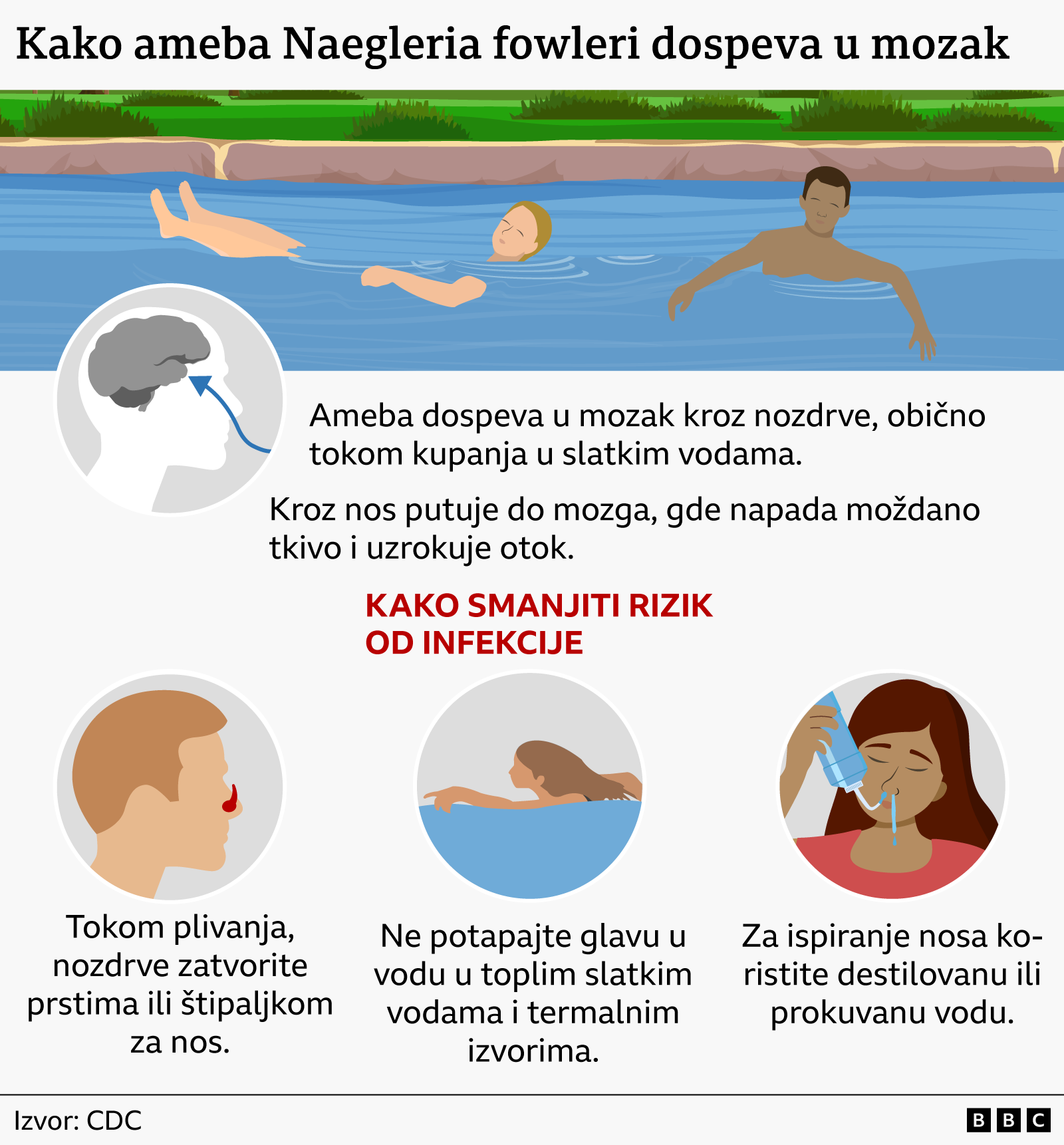 'Kao u horor filmu': Ameba koja jede mozak bi mogla da se proširi po svetu 4 grafik