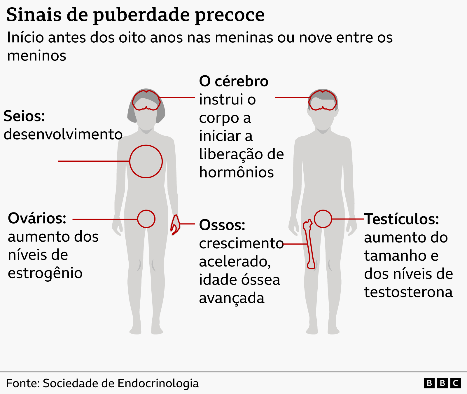 Ilustração gráfica de corpo masculino e feminino, indicando os sinais da puberdade precoce em crianças