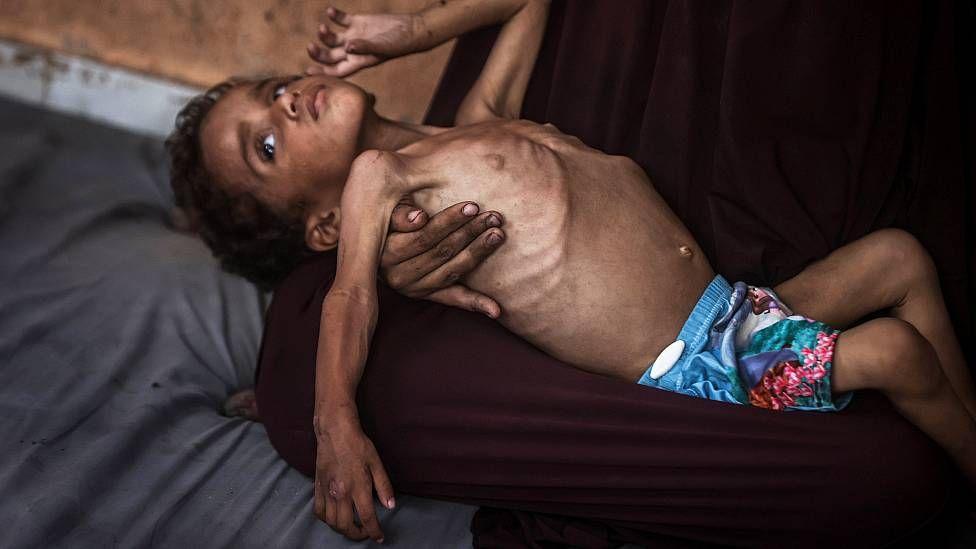 Yezen, un niño de dos años, en el regazo de su madre
