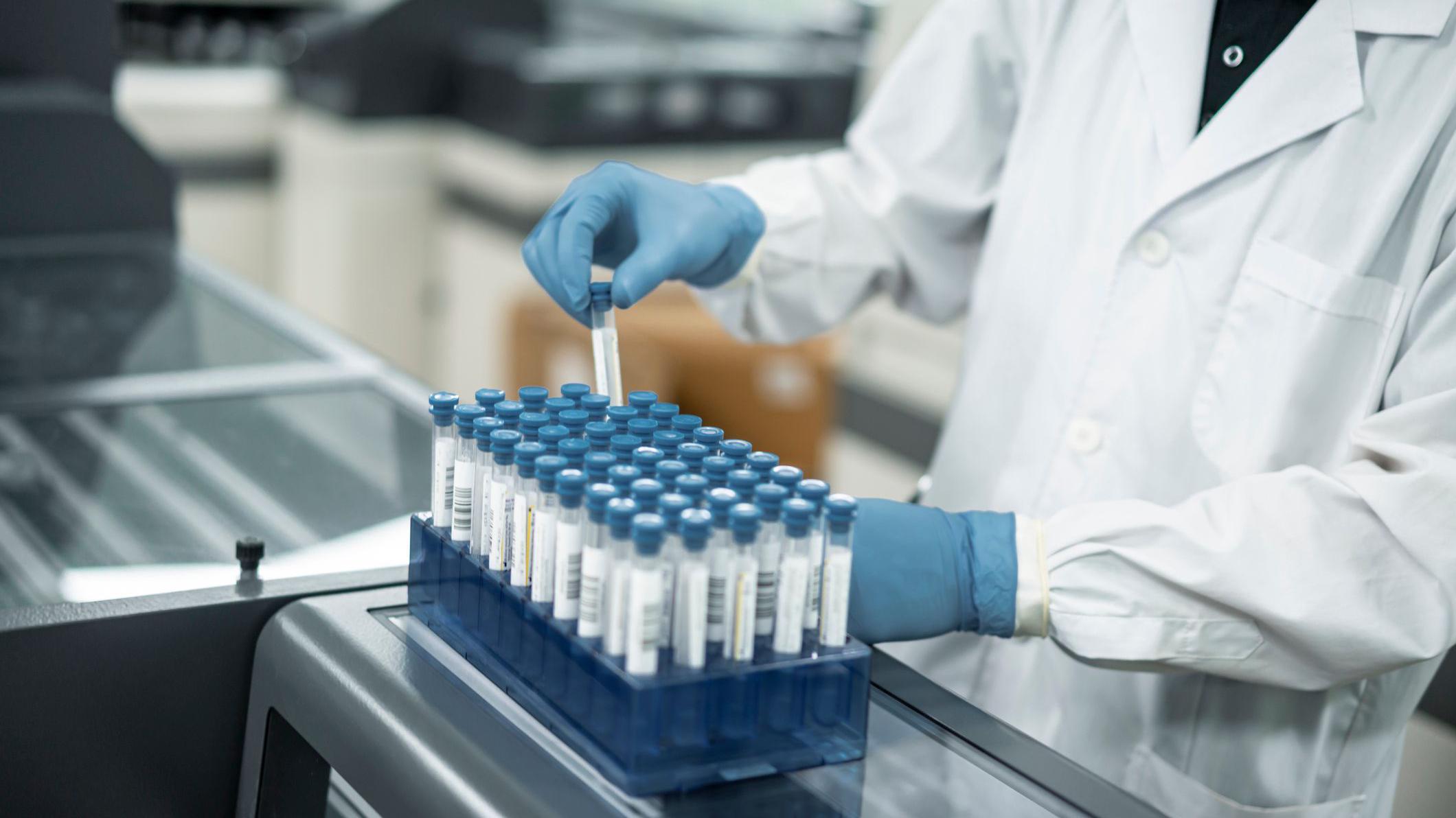 Foto de um laborat&oacute;rio com tubos de coleta de exames.