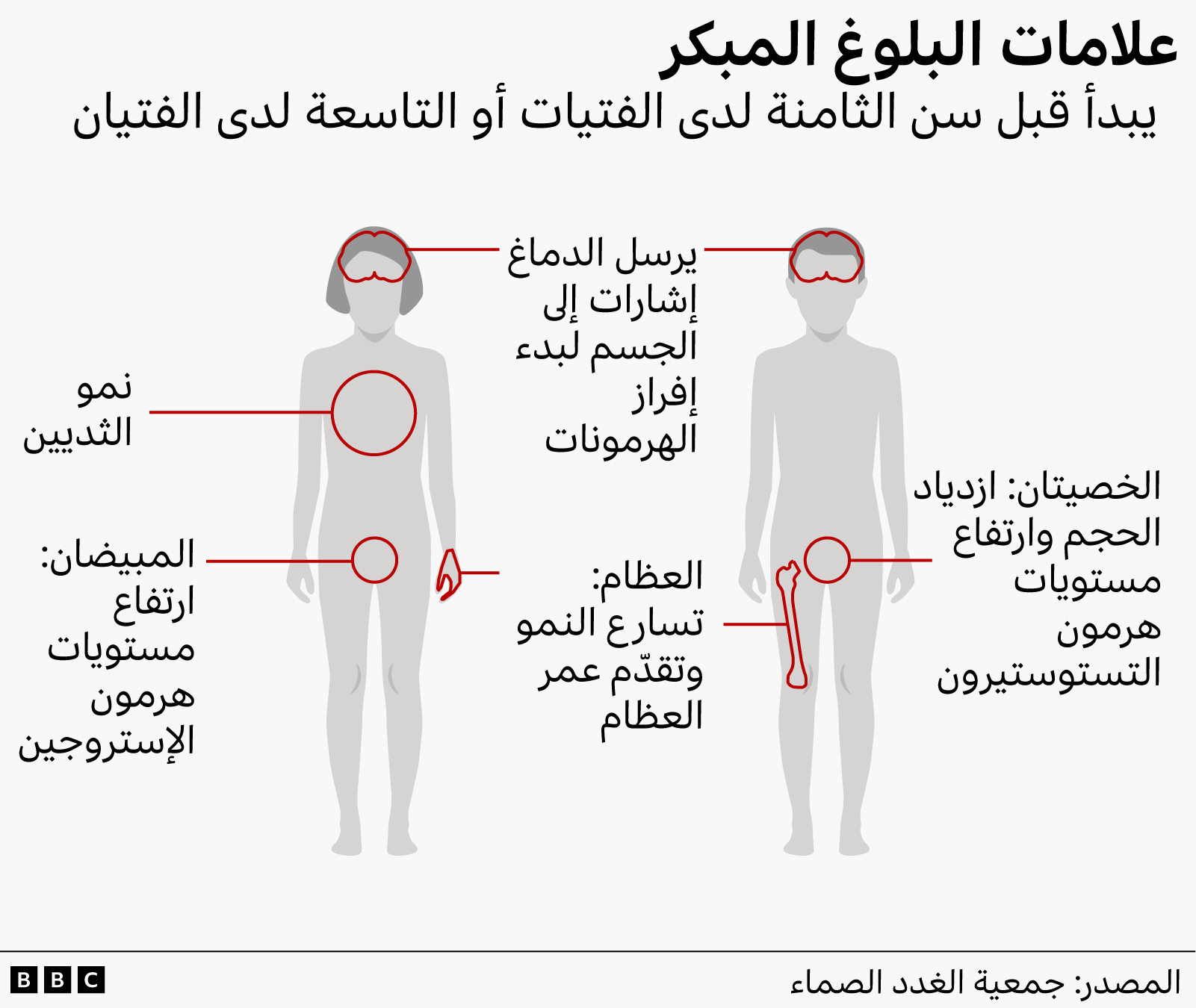 جرافيك يوضّح علامات البلوغ المبكر لدى الأطفال على رسم توضيحي لجسدي فتى وفتاة 