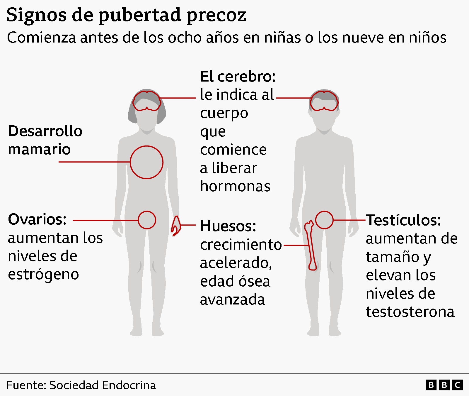 Una ilustración gráfica de un cuerpo masculino y uno femenino señala los signos de pubertad precoz en los niños.