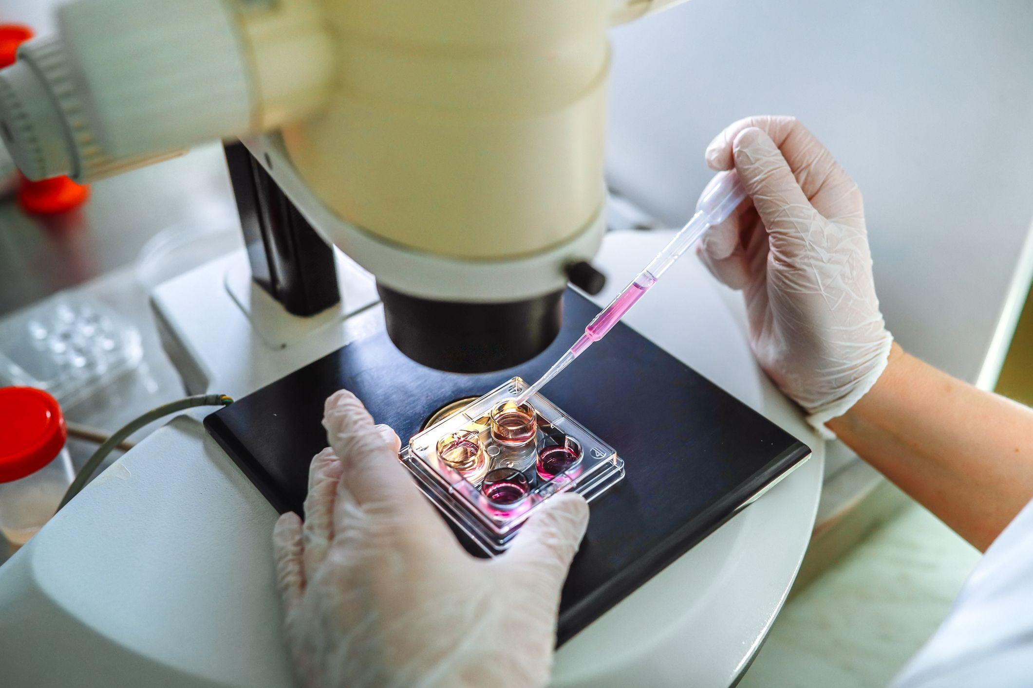 Manos con guantes usando una pipeta para añadir líquido a una placa de cultivo sobre un microscopio en laboratorio.