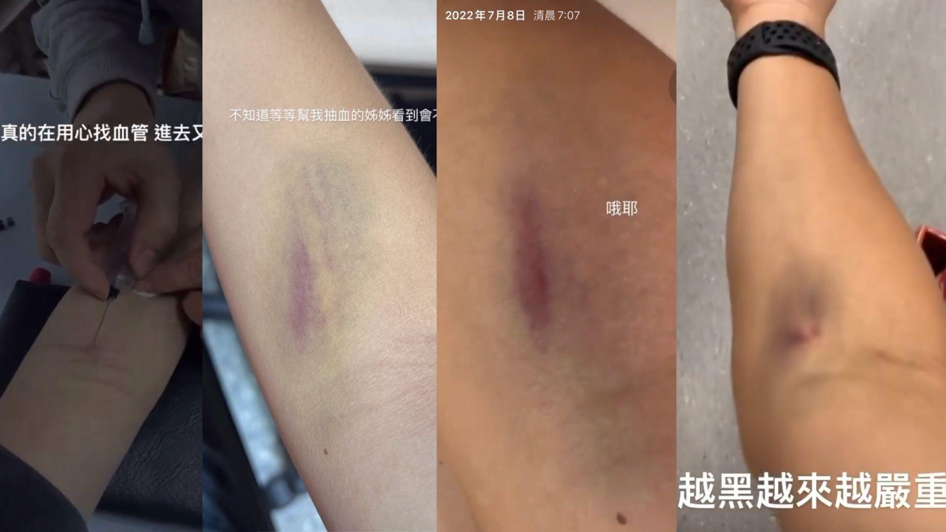 簡奇陞在社群媒體公開被抽血的影片