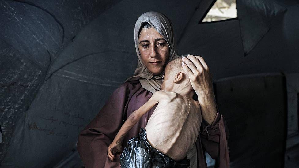 Muhammad Zakariya Ayyoub al-Matouq, con los huesos visiblemente marcados, en los brazos de su madre