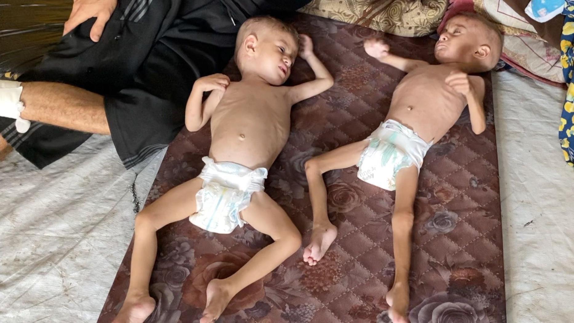 صورة الطفلين عدي ومحمد في آب/أغسطس 2025 عظامهما بارزة ويبدو عليهما أثر سوء التغذية. 