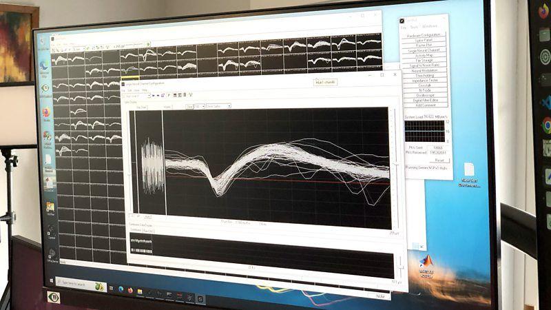 Tela de computador mostrando gr&aacute;fico da atividade cerebral de uma pessoa