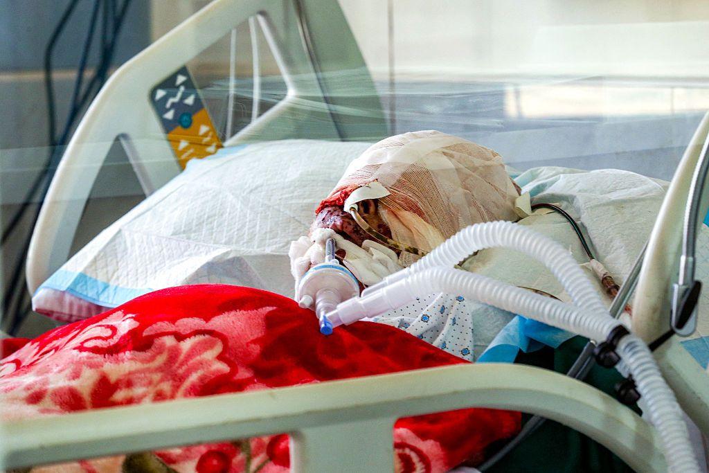  أسيل شرارة، الطفلة الكبرى من العائلة المستهدفة في بنت جبيل، مصابة بجروح بالغة وترقد موصولة بجهاز تنفس صناعي في وحدة العناية المركزة في أحد مستشفيات جنوب لبنان في 22 سبتمبر/أيلول 2025.