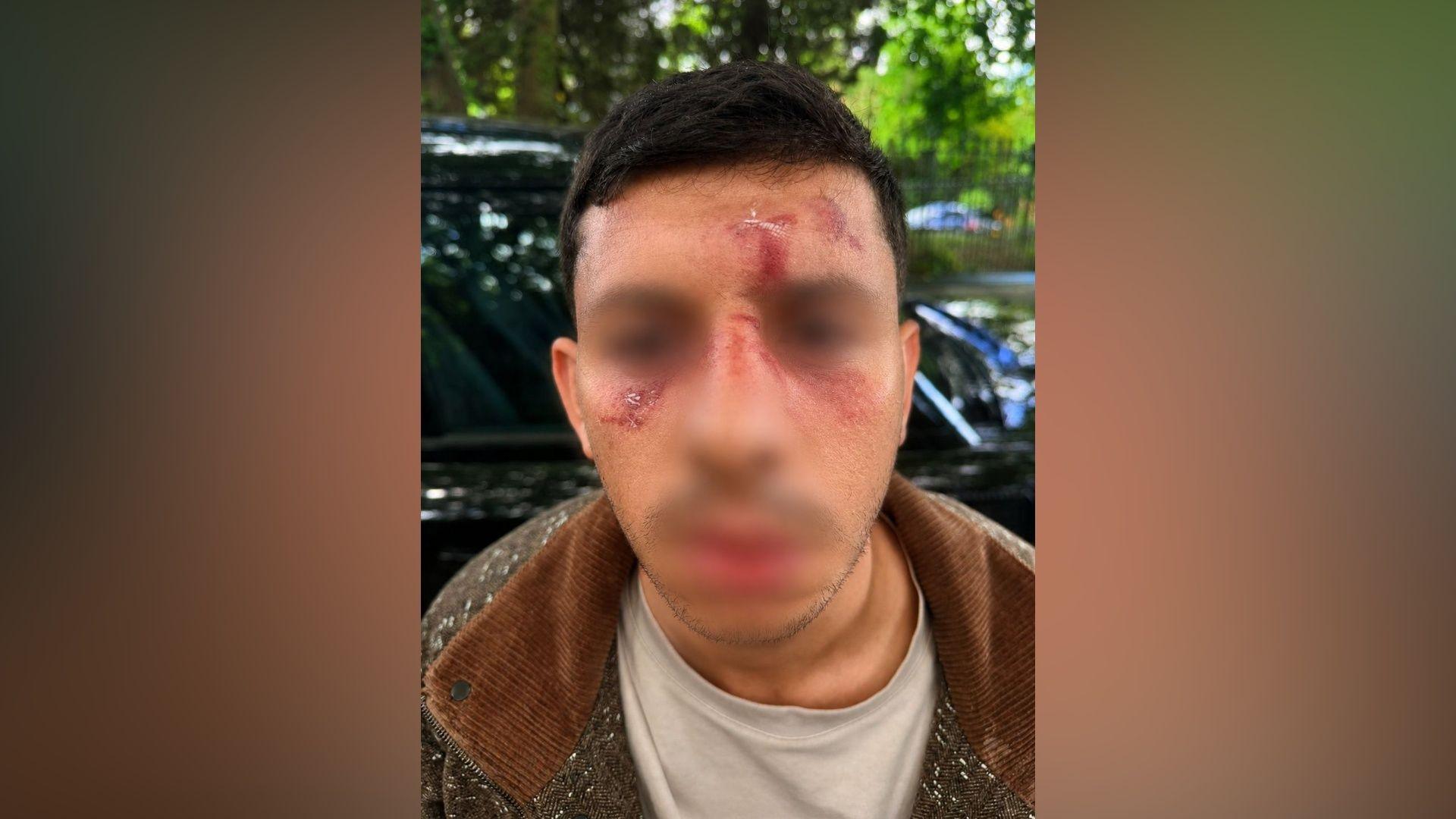 Jewish man kicked like animal in Golders Green attack