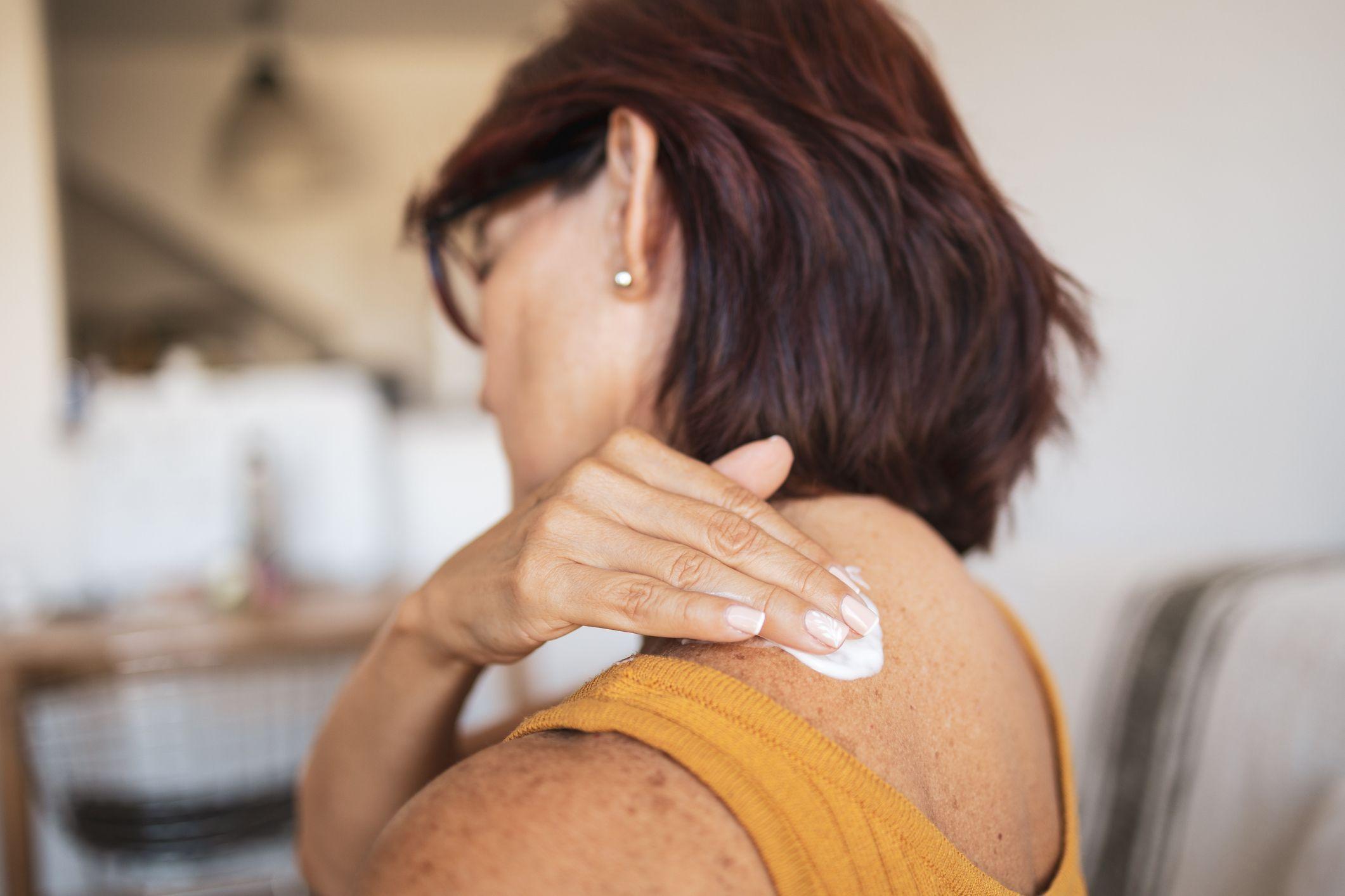 žena, menopauza, žena stavlja obloge, hormonska supstituciona terapija je dostupan u nekoliko oblika: pilule, flasteri i gelovi