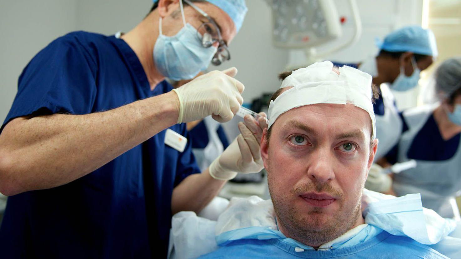 O cirurgi&atilde;o Greg Williams realiza um transplante capilar em um paciente