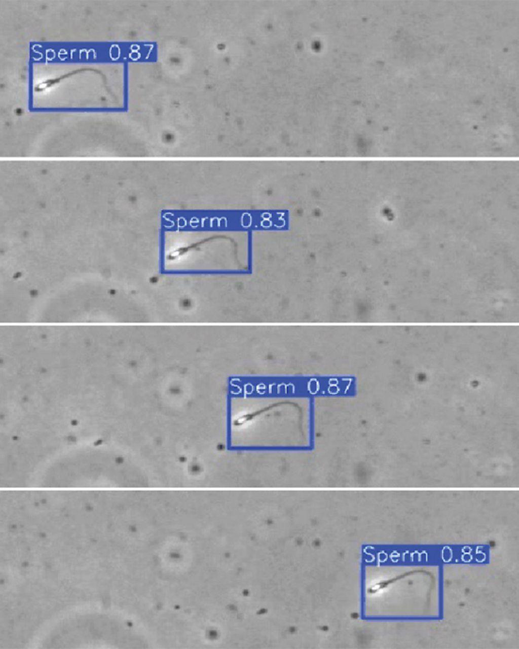 Imagen microscópica de espermatozoides marcados con recuadros y porcentajes de detección automática.