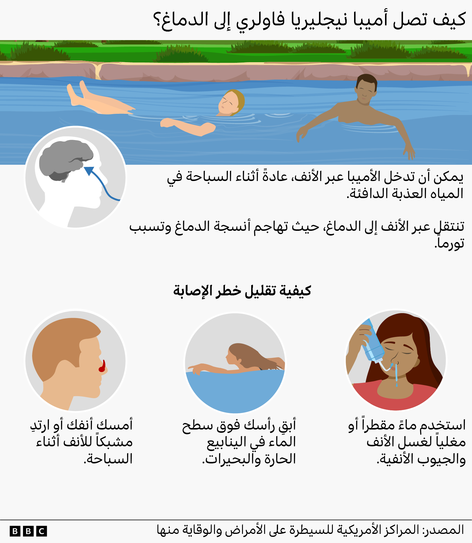 رسم توضيحي يوضح كيفية وصول أميبا نيجليريا فاوليري إلى الدماغ. 
مكتوب بالعربية: "يمكن أن تدخل الأميبا عبرالأنف عادة أثناء السباحة في المياه العذبة الدافئة. تنتقل عبر الأنف إلى الدماغ، حيث تهاجم أنسجة الدماغ وتسبب تورماً".
كيفية تقليل خطر الإصابة:
تحت رسم امرأة: استخدم ماء مقطراً مغلياً لغسل الأنف والجيوب الأنفية. 
تحت رسم امرأة تسبح: ابق رأسك فوق سطح الماء في الينابيع الحارة والبحيرات.
تحت رسم لوجه جانبي لرجل: أمسك أنفك أو ارتد مشبكاً للأنف أثناء السباحة. 