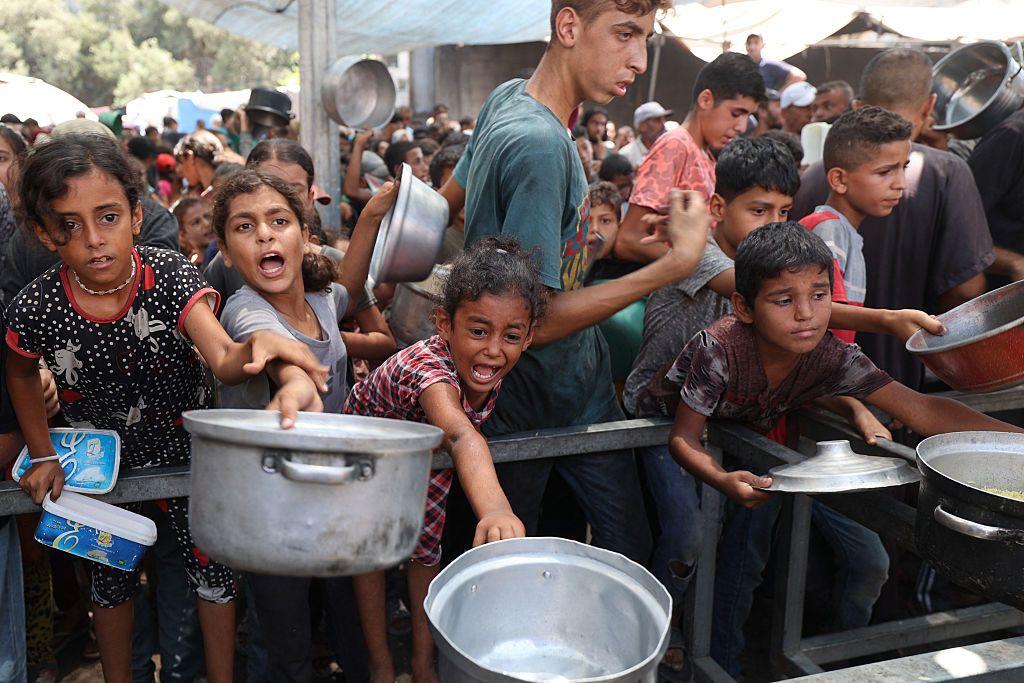 Niños desnutridos en Gaza