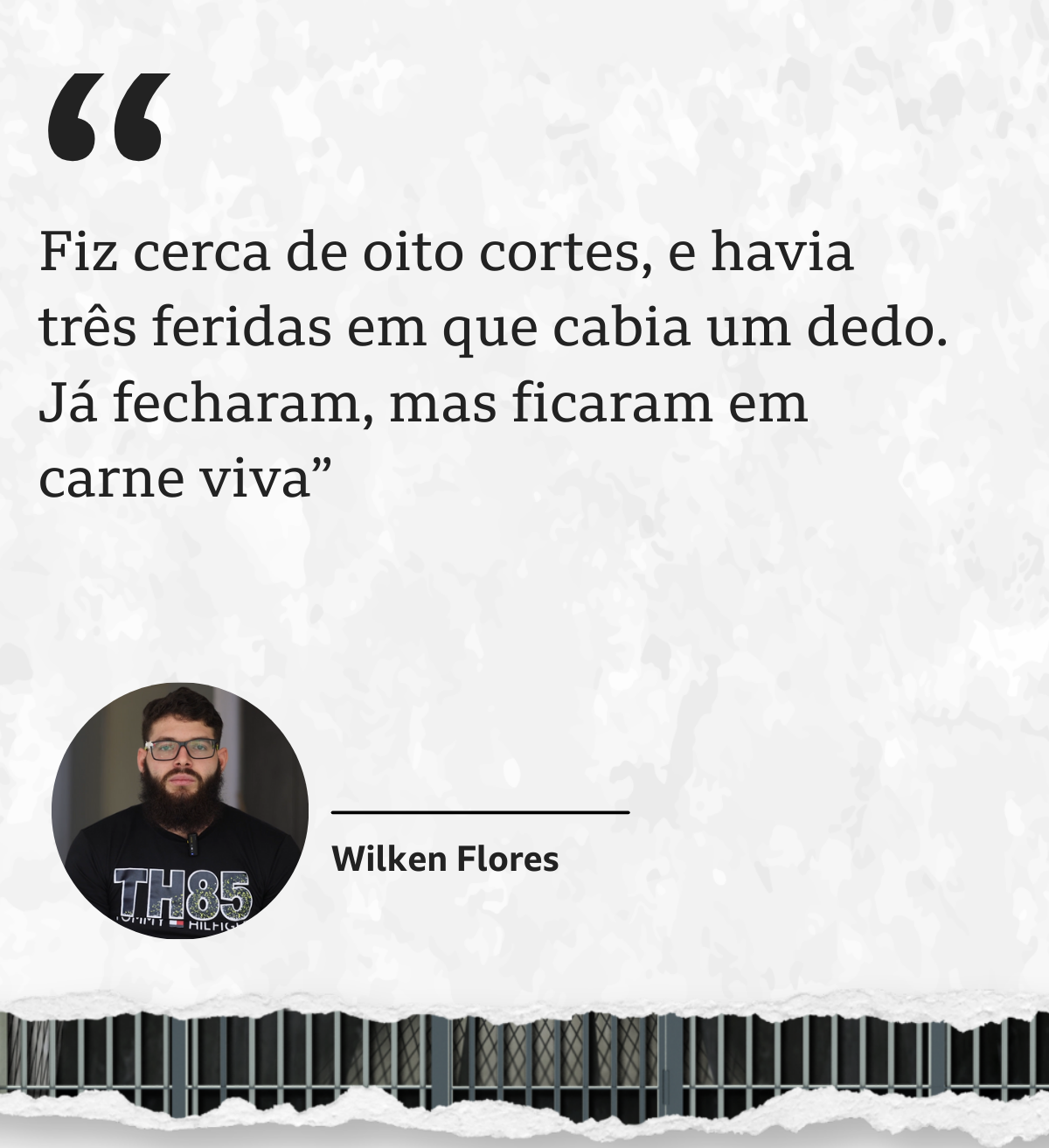 Foto de Wilken Flores com a seguinte aspa: 'Fiz cerca de oito cortes, e havia três feridas em que cabia um dedo. Já fecharam, mas ficaram em carne viva'