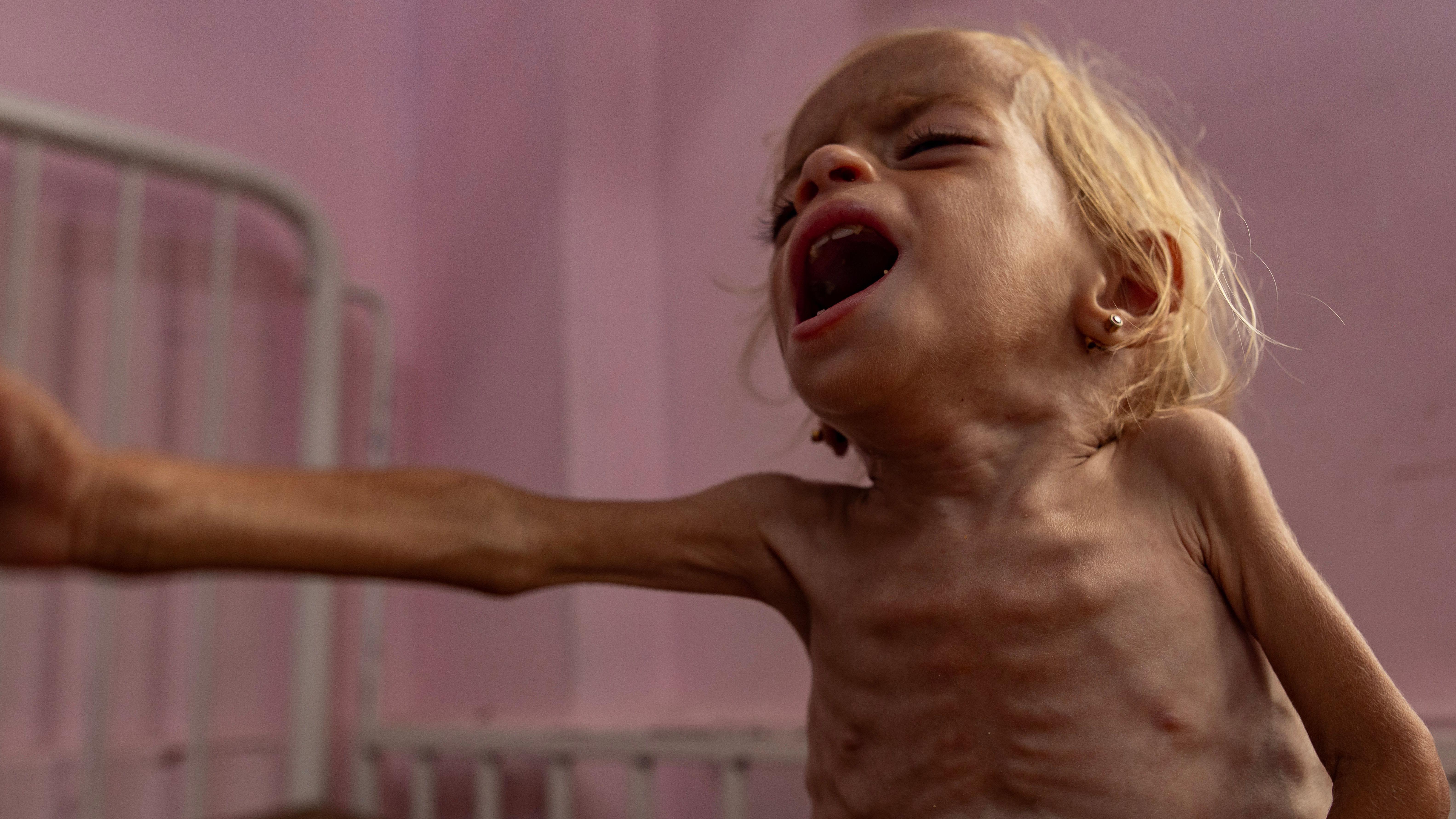 Criança palestina em meio à fome crescente em Gaza