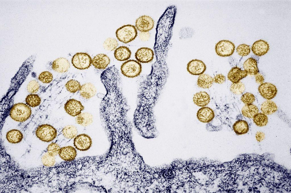 Os hantav&iacute;rus que causam a S&iacute;ndrome Pulmonar por Hantav&iacute;rus (HPS) s&atilde;o transmitidos pelas fezes de roedores