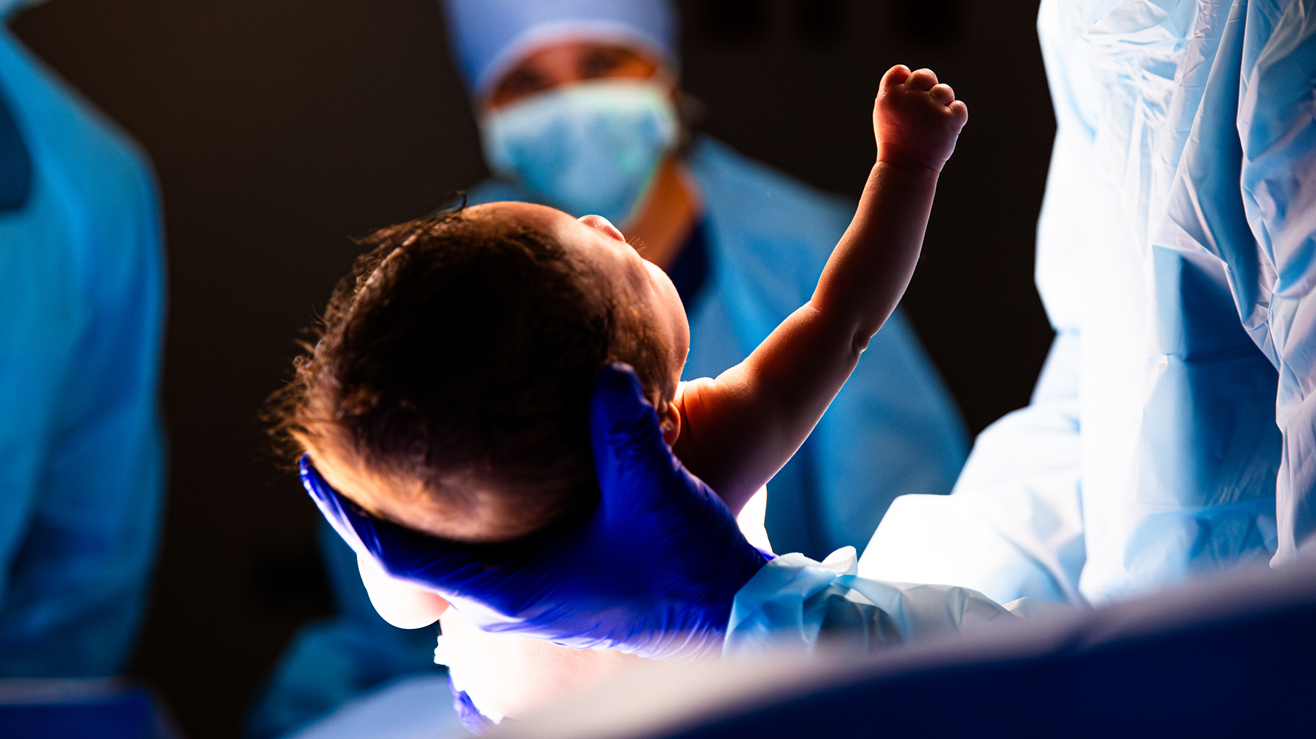 Un bebé recién nacido es cargado por un médico que tiene un guante azul. De fondo, una médica, con mascarilla, bata y gorros azules, ve al bebé